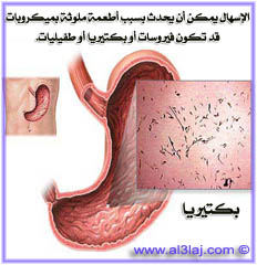 الإسهال قد يحدث بسبب البكتيريا أو الطفيليات