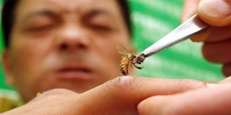 الكوبيون يستخدمون لدغة النحل لعلاج التهاب المفاصل