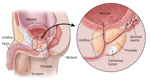 prostate