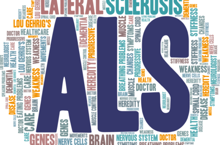 التصلب الجانبي الضموري (ALS) – الأسباب والأعرض والتشخيص والعلاج