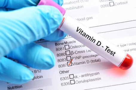 تحليل فيتامين د – 5 أسباب تدفعك لفحص مستوى فيتامين د في جسمك