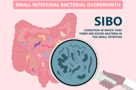 فرط النمو البكتيري في الأمعاء SIBO – ما هي أعراضه وأسبابه