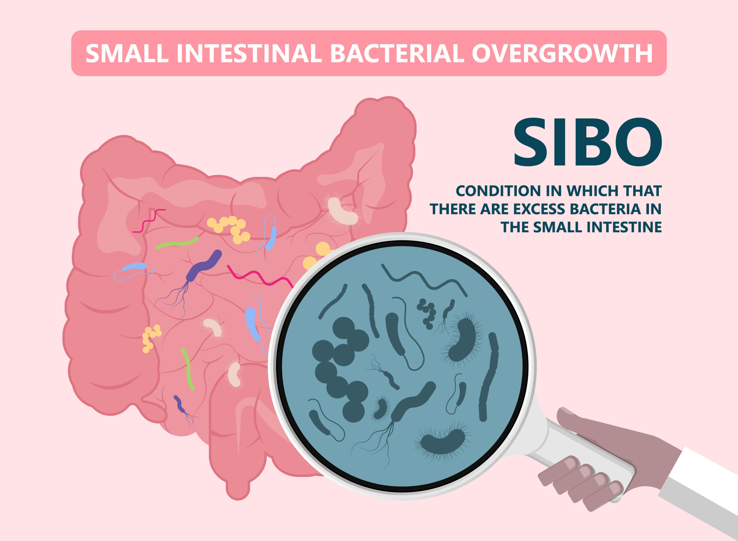فرط النمو البكتيري في الأمعاء SIBO