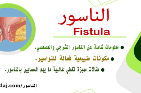 الناسور  Fistula